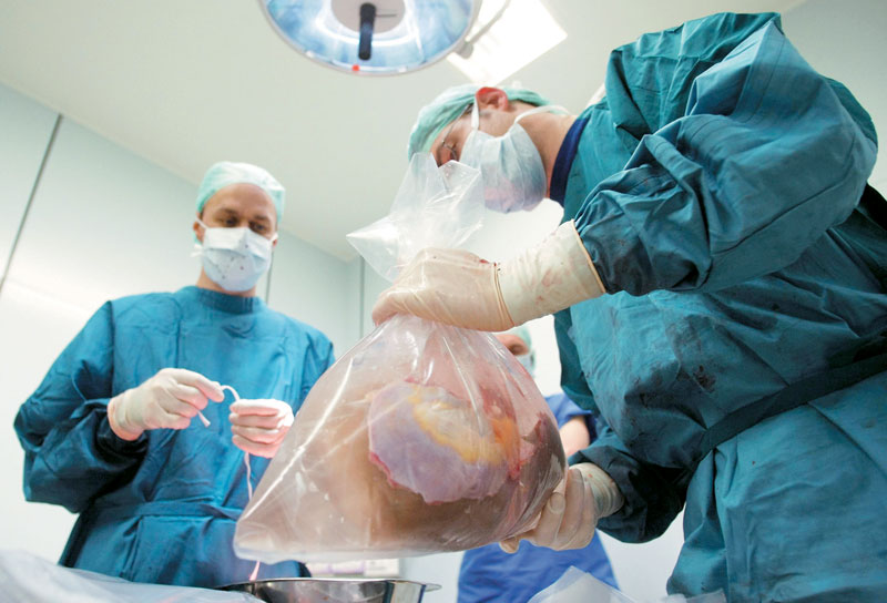 Χάρισε ζωή σε 5 ανθρώπους 22χρονος δότης οργάνων