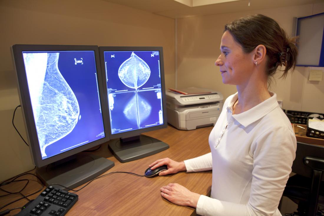 Σπουδαία ανακάλυψη επιστημόνων για τον καρκίνο του μαστού